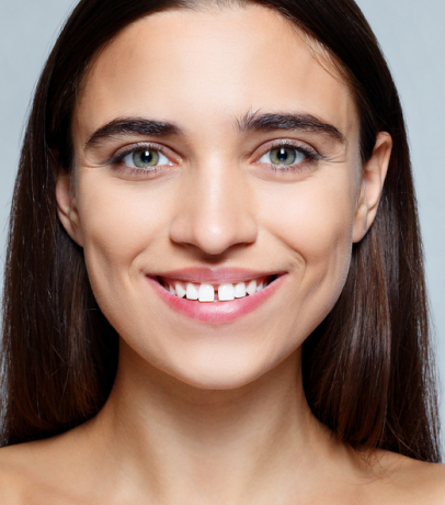 a girl smiling with disaligned teeth