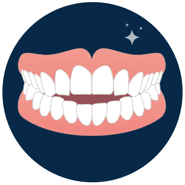 Clear Aligners in Kerala - Digitace aligners a photo of a disaligned teeth