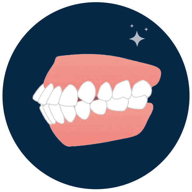 Clear Aligners in Kerala - Digitace aligners a photo of a disaligned teeth